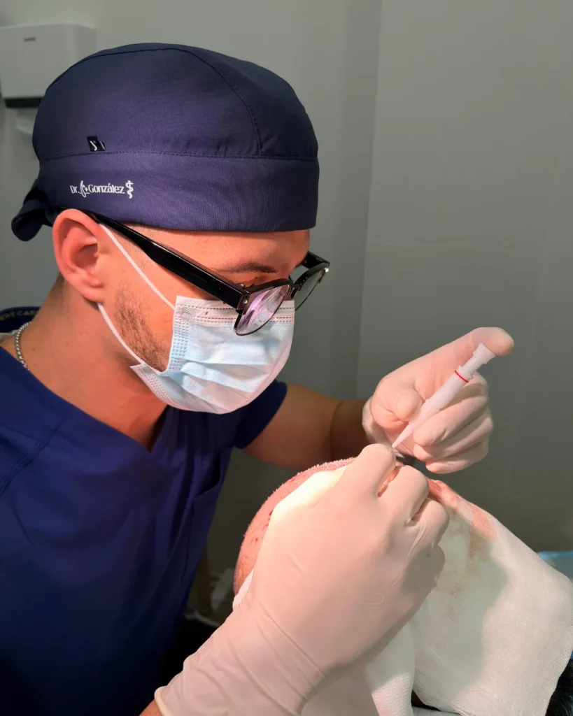 cirugía capilar con técnica dhi